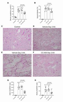 c-Jun Amino Terminal Kinase Signaling Promotes Aristolochic Acid-Induced Acute Kidney Injury